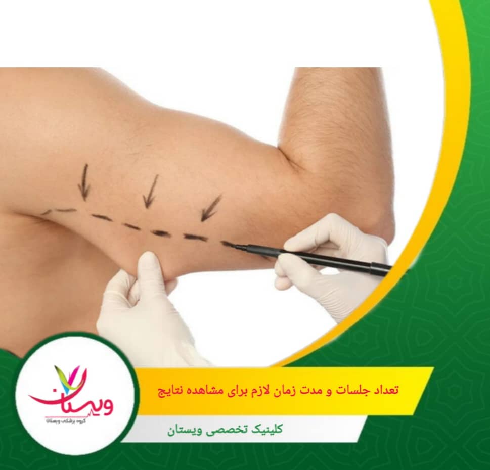 شرایط بدنی، سطح استرس و کیفیت خواب میتوانند بر سرعت پاسخدهی به درمان تأثیر بگذارند. تعداد جلسات و مدت زمان لازم برای مشاهده نتایج