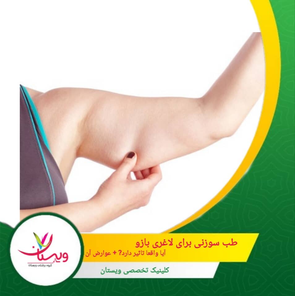 طب سوزنی برای لاغری بازو| آیا واقعا تأثیر دارد؟ + عوارض آن