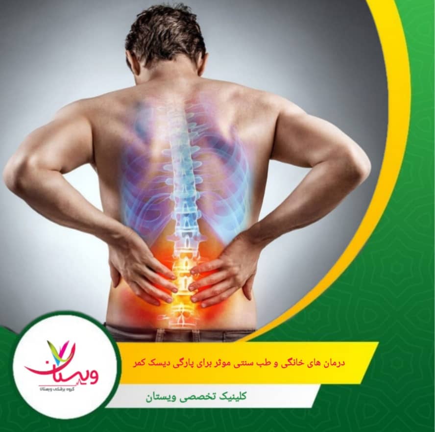 استفاده از کمپرس گرم یا سرد برای کاهش التهاب و تسکین درد. درمانهای خانگی و طب سنتی مؤثر برای پارگی دیسک کمر