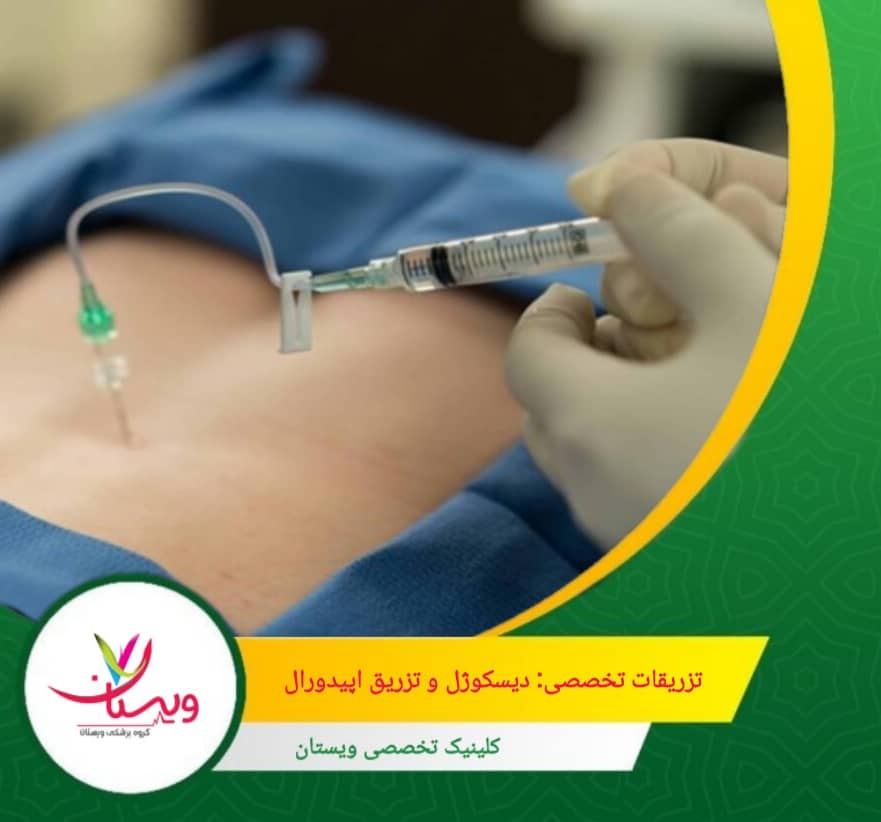 تزریق اپیدورال نیز با هدف کاهش التهاب و تسکین درد، داروهای ضدالتهاب مانند کورتیکواستروئیدها را در فضای اطراف عصبهای نخاعی تزریق میکند. تزریقات تخصصی: دیسکوژل و تزریق اپیدورال