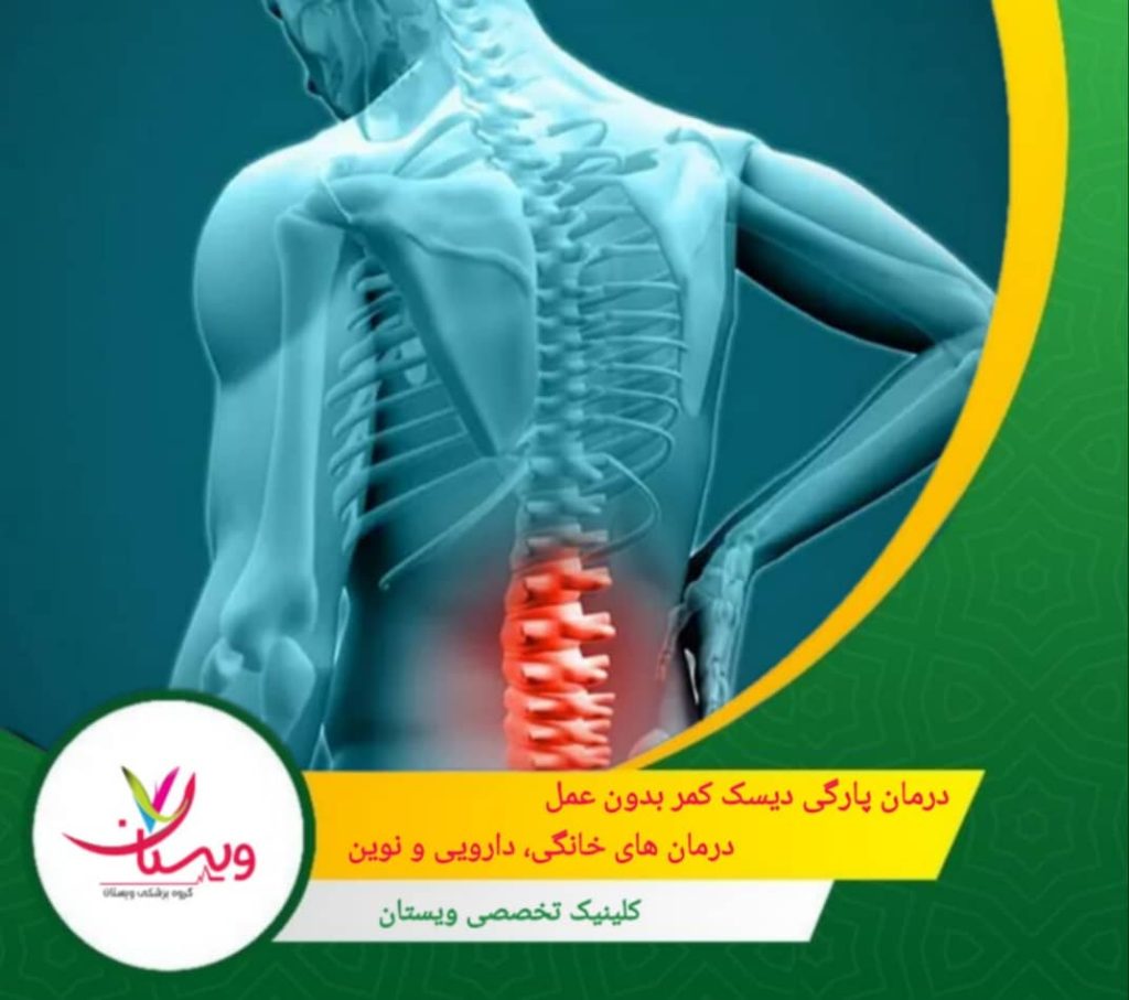 درمان پارگی دیسک کمر بدون عمل| درمان های خانگی، دارویی ونوین