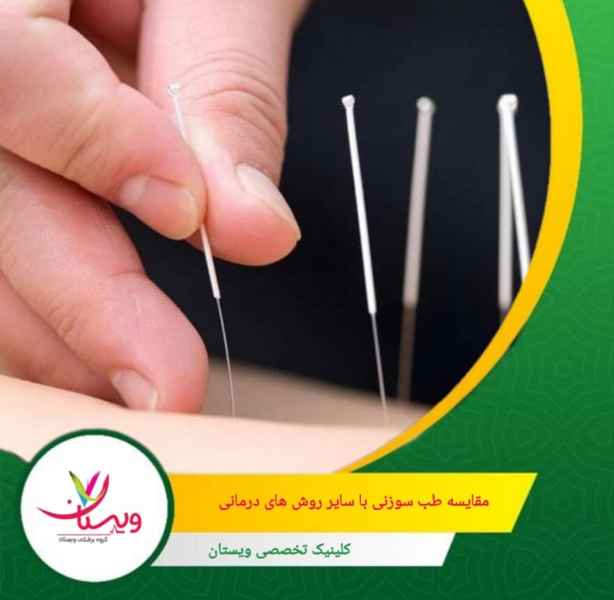 درمان بدون دارو، بهبود جریان انرژی از مزایا طب سوزنی می باشد. مقایسه طب سوزنی با سایر روشهای درمانی