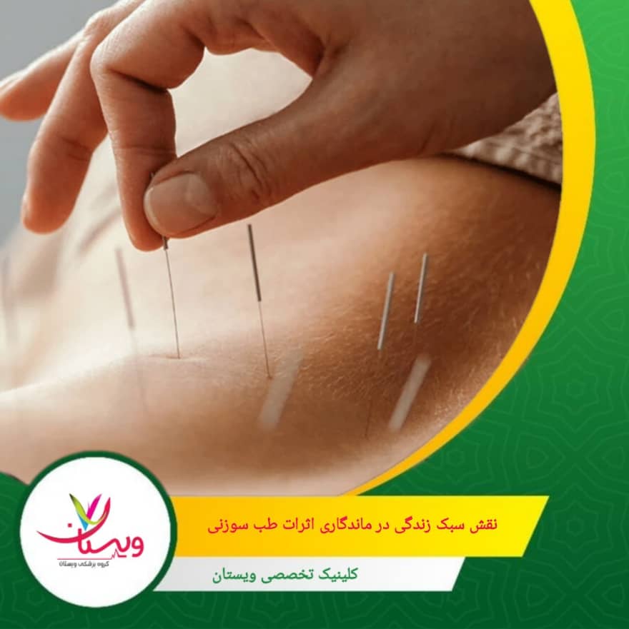 رعایت توصیههای درمانگر، از جمله تغییرات در سبک زندگی، رژیم غذایی و فعالیتهای روزانه، میتواند به افزایش ماندگاری اثرات درمان کمک کند. نقش سبک زندگی در ماندگاری اثرات طب سوزنی