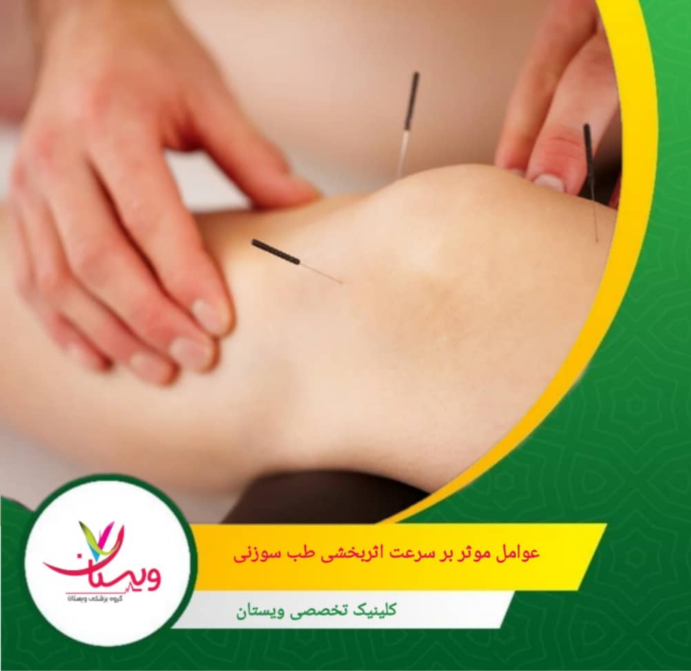 افرادی که به طب سوزنی باور دارند و با ذهنی آرام وارد جلسات میشوند، نتایج بهتری میگیرند (پدیده پلاسبو هم مؤثر است). عوامل مؤثر بر سرعت اثربخشی طب سوزنی