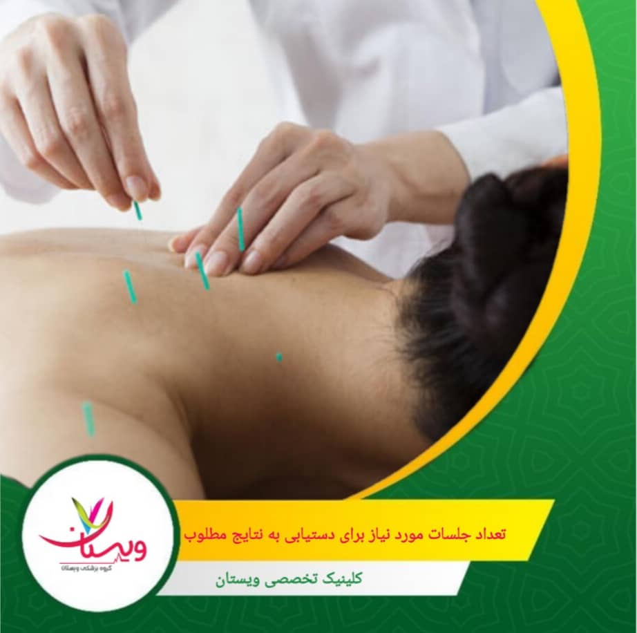 در موارد حاد، توصیه میشود جلسات طب سوزنی بهصورت دو تا سه بار در هفته برای مدت دو تا سه هفته انجام شود. تعداد جلسات لازم برای دستیابی به نتایج مطلوب