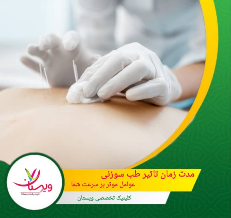 مدت زمان تاثیر طب سوزنی و عوامل موثر بر سرعت بهبود شما
