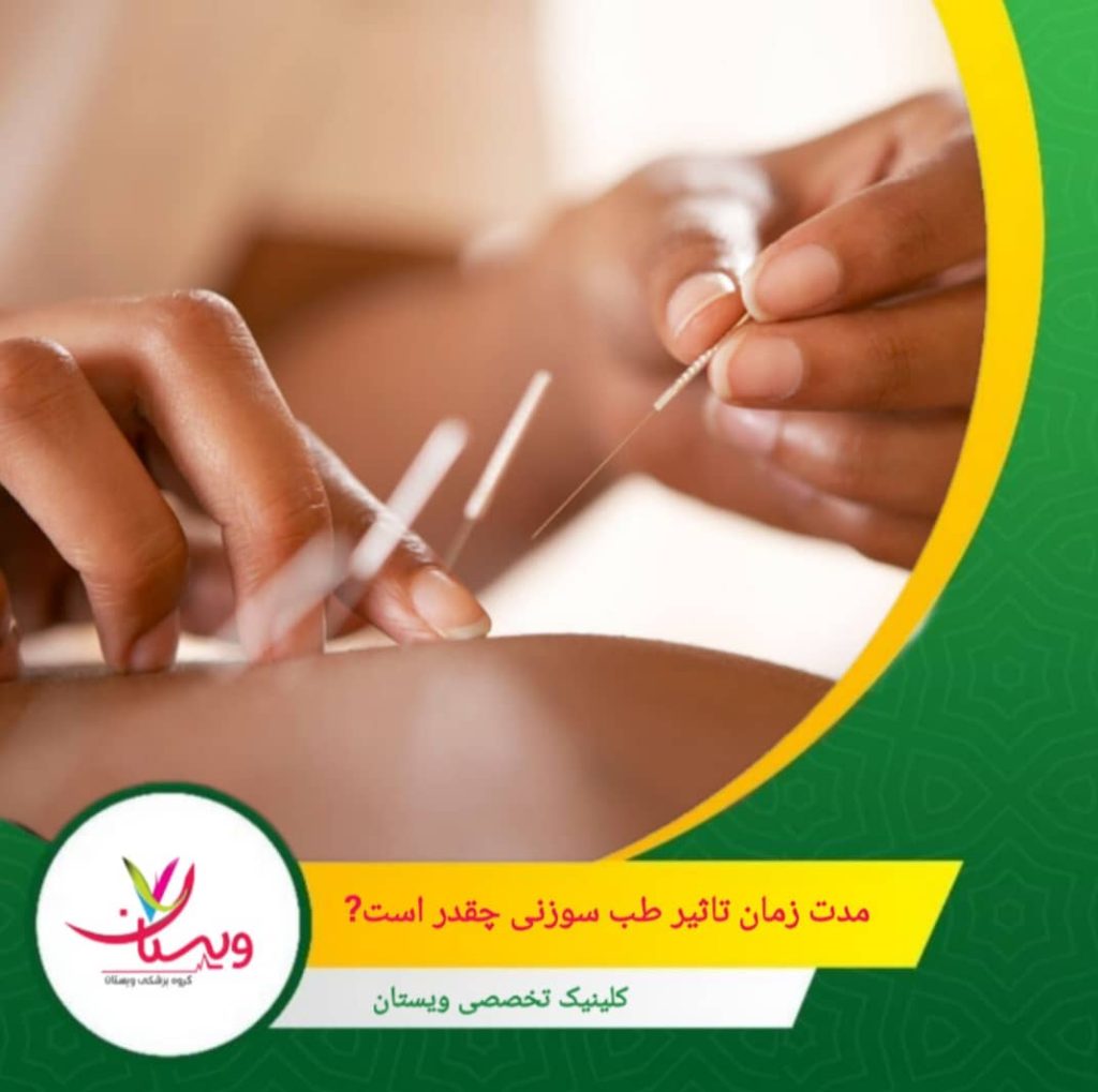 به عوامل متعددی بستگی دارد، از جمله نوع بیماری، شدت علائم، و واکنش فرد به درمان. مدت زمان تاثیر طب سوزنی چقدر است؟
