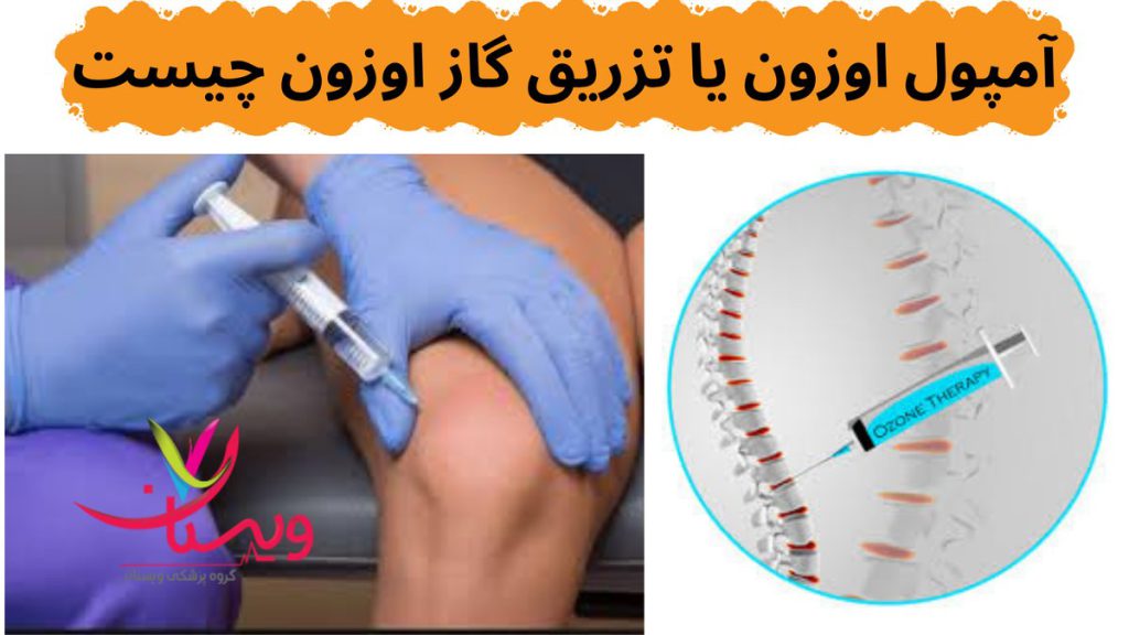 اوزون درمانی قیمت آمپول اوزون پیک زانو