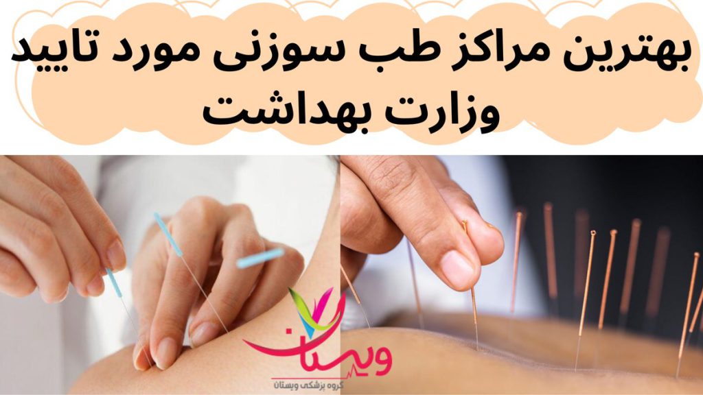 مراکز طب سوزنی بهترین مراکز طب سوزنی مورد تایید وزارت بهداشت