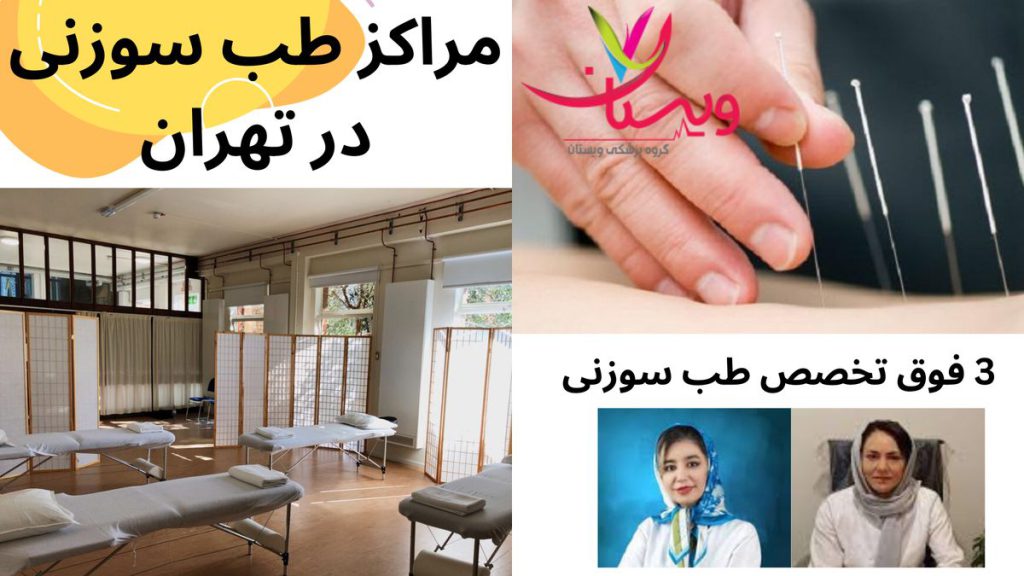 بهترین کلینیک و مراکز طب سوزنی در تهران
