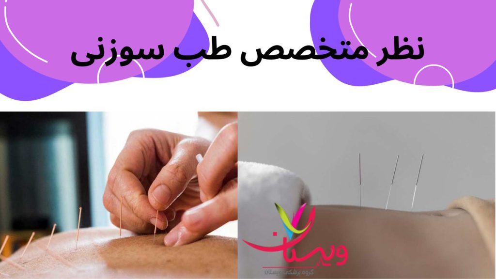 اصول طب سنتی نظر متخصص طب سوزنی