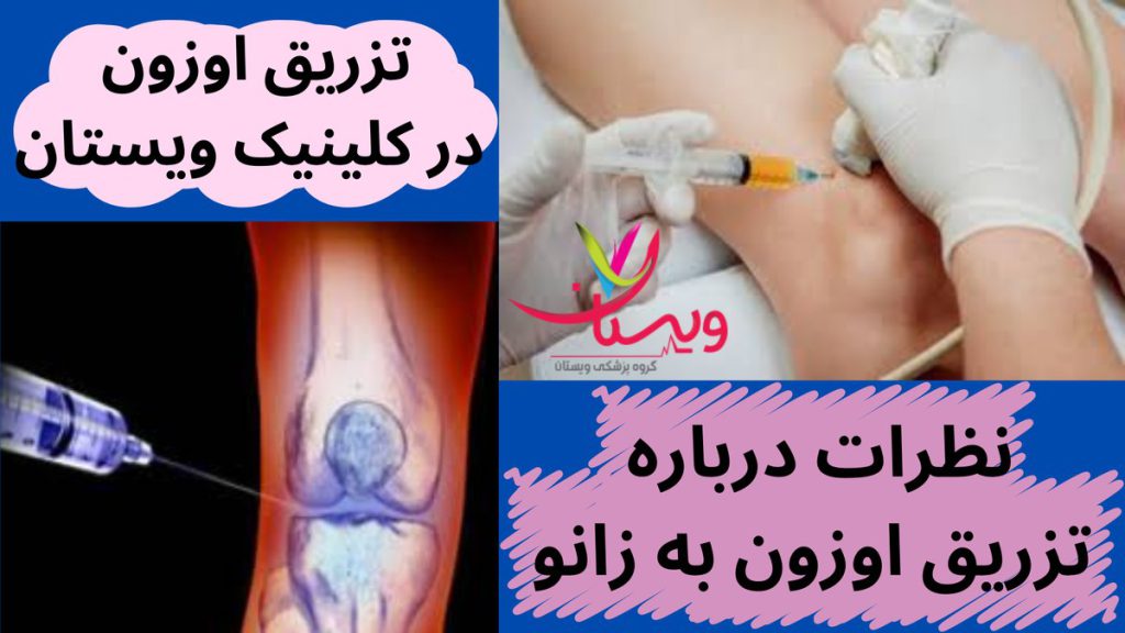 جراحی زانو نظرات درباره تزریق اوزون به زانو