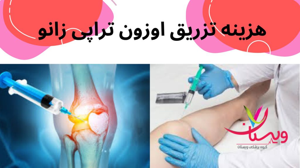 اوزون تراپی زانو هزینه تزریق اوزون تراپی زانو