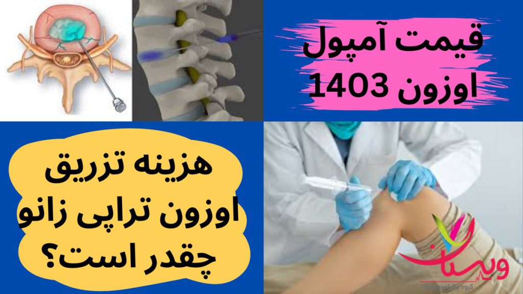 تزریق گاز اوزون هزینه اوزون تراپی زانو 1403چقدر است