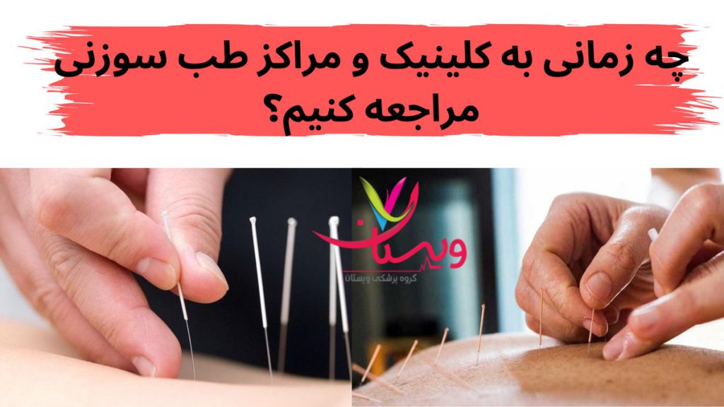 کلینیک و مراکز طب سوزنی چه زمانی نیاز است به کلینیک و مراکز طب سوزنی در تهران مراجعه کنیم
