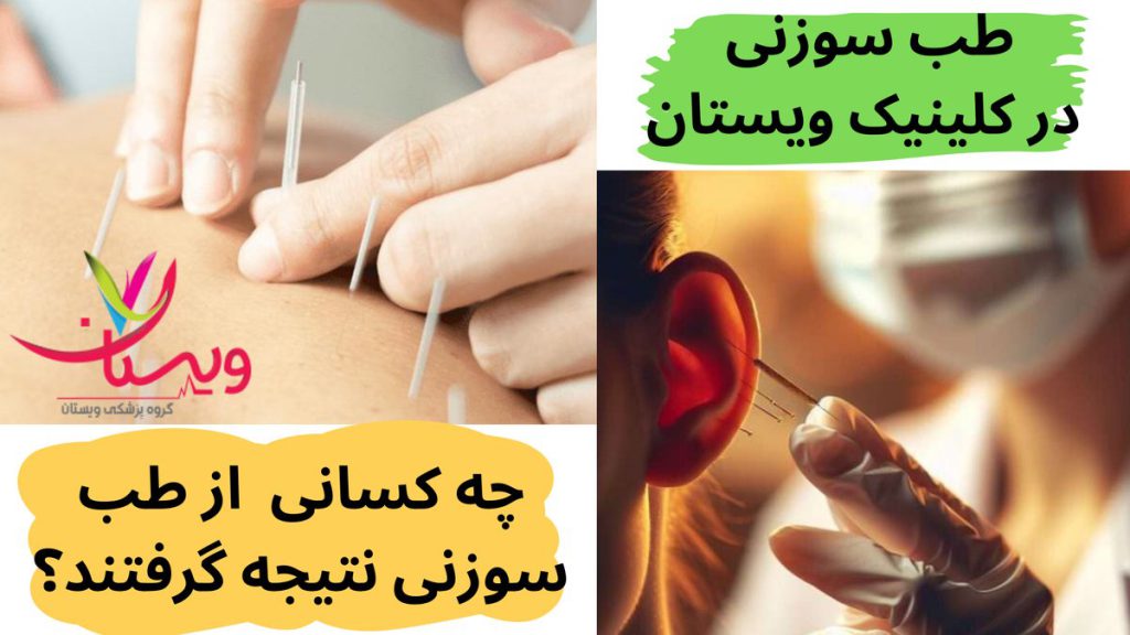 کلینیک ویستان چه کسانی در کلینیک ویستان از طب سوزنی نتیجه گرفتند