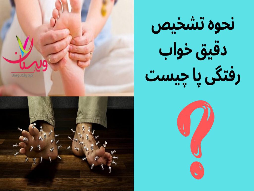آزمایشهای عصبشناسی نحوه تشخیص دقیق خواب رفتگی پا چیست
