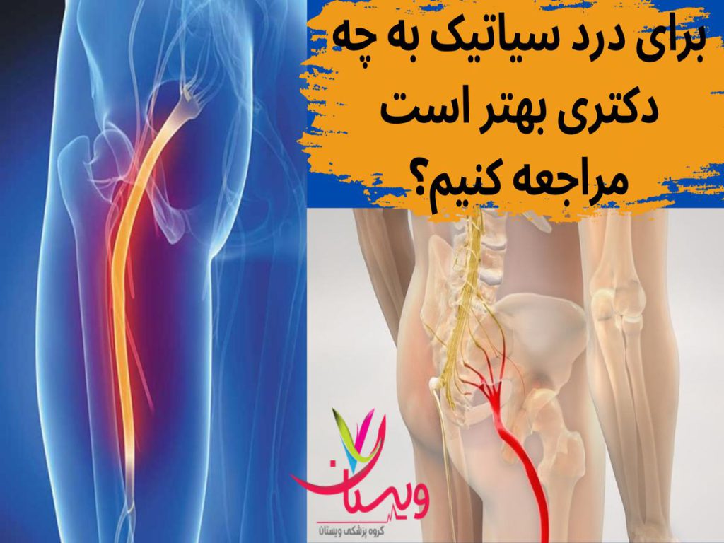 درمان درد سیاتیک برای درد سیاتیک به چه دکتری بهتر است مراجعه کنیم