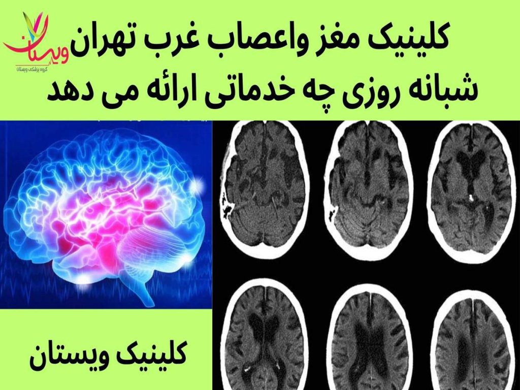 کلینیک فوق تخصصی مغز و اعصاب 24 ساعته خدمات کلینیک مغز و اعصاب شهرک غرب