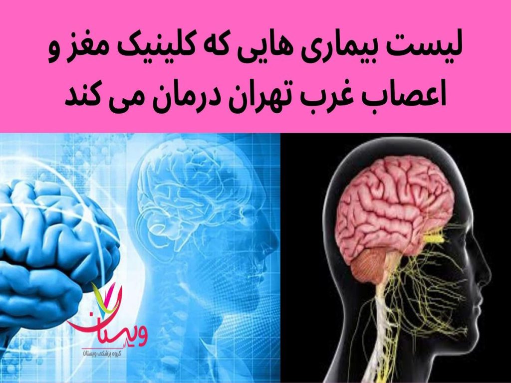 درمان بیماری مغزی در کلینیک مغز و اعصاب غرب تهران لیست بیماری های تحت درمان توسط کلینیک مغز و اعصاب شهرک غرب
