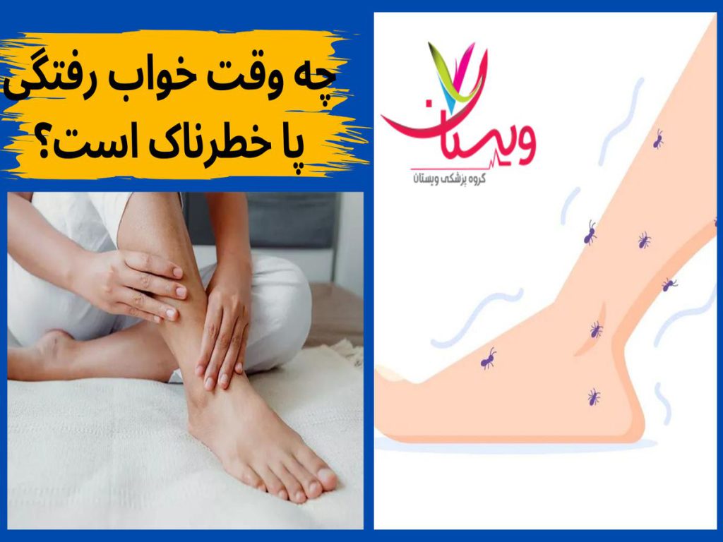 خواب رفتگی پا با درد شدید چه وقت خواب رفتگی پا خطرناک است