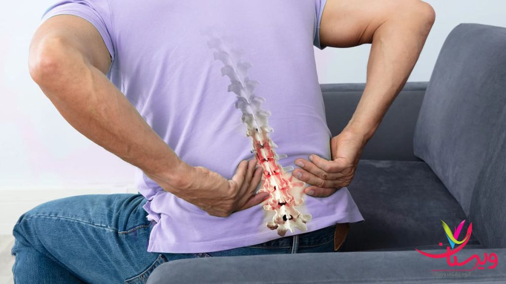 مردی که از درد کمر دستهایش را روی کمر گذاشته