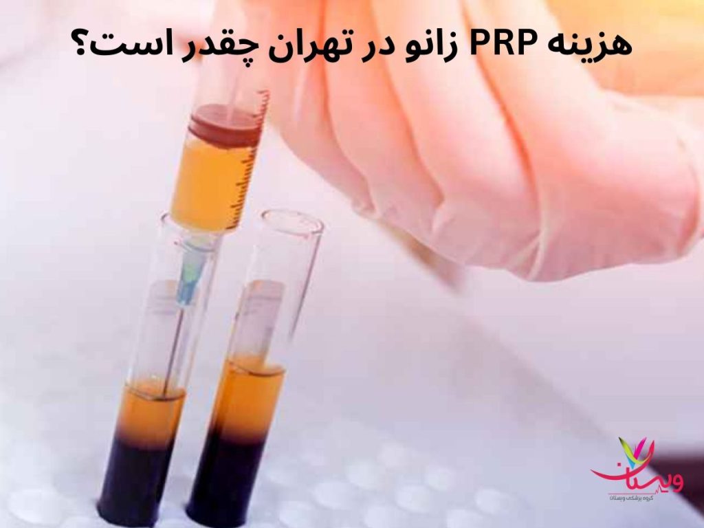 پی آر پی زانو قیمت های تزریق پی آر پی تهران