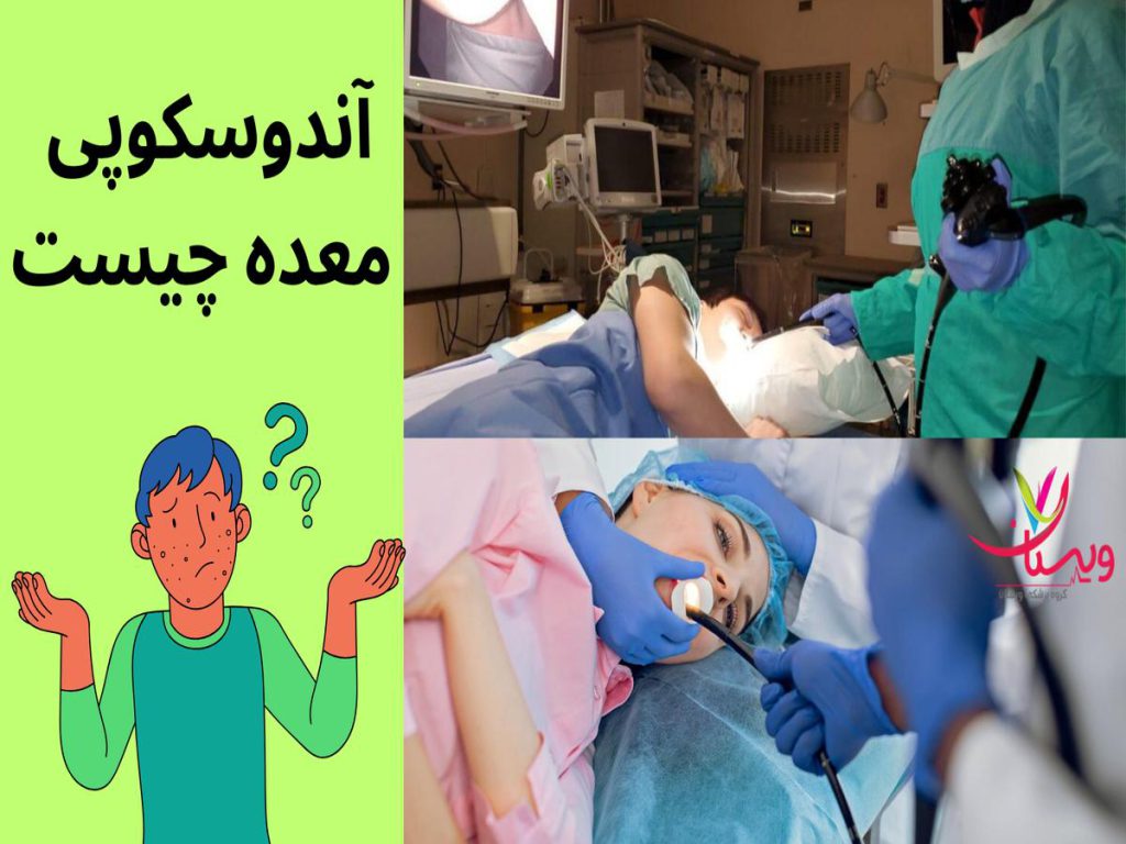 گاستروسکوپی آندوسکوپی معده چیست