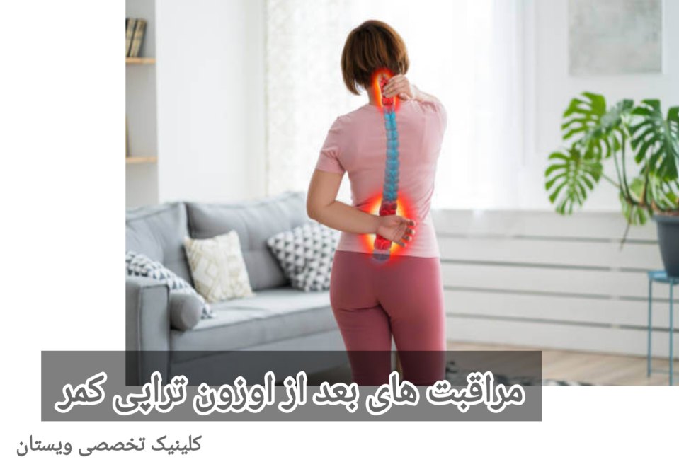 انجام تمرینات فیزیکی که پزشک شما توصیه کرده، میتواند به افزایش موفقیت درمان کمک کند و روند بهبودی را تسریع بخشد. مراقبت های بعد از اوزون تراپی دیسک کمر