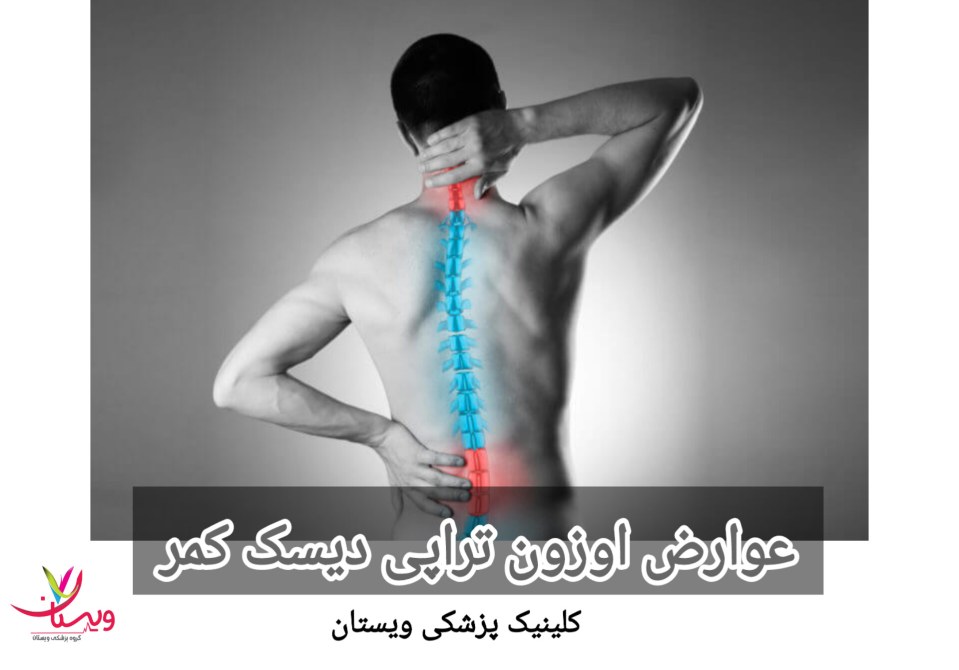 بعضی از بیماران در ناحیه تزریق ممکن است احساس سوزش یا گرما کنند که این نیز یک واکنش طبیعی است. عوارض اوزون تراپی دیسک کمر
