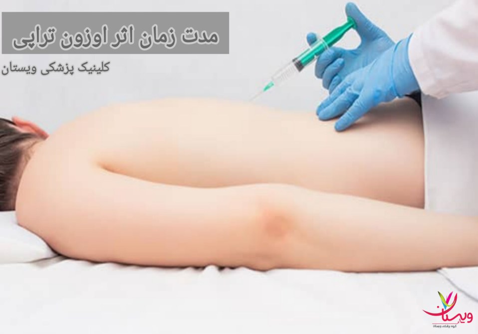 هر فرد به اوزون تراپی به شیوهای متفاوت پاسخ میدهد و این موضوع میتواند بر مدت زمان اثرگذاری تأثیرگذار باشد. مدت زمان اثر اوزون تراپی