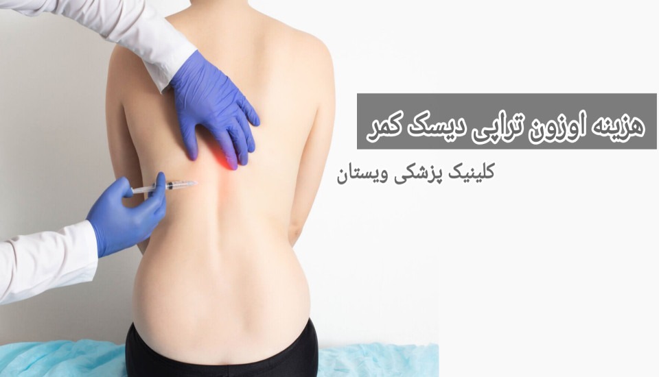 کلینیک ویستان با به کارگیری تجهیزات پیشرفته و پزشکان متخصص، خدمات اوزونتراپی را با کیفیتی بالا به بیماران ارائه میدهد. هزینه اوزون تراپی دیسک کمر
