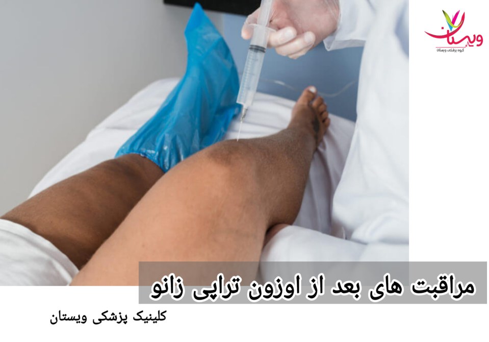 در زمان استراحت، زانو را بالاتر از سطح قلب قرار دهید تا ورم کاهش یابد و مایع اضافی تجمع پیدا نکند. مراقبت های بعد از اوزون تراپی زانو