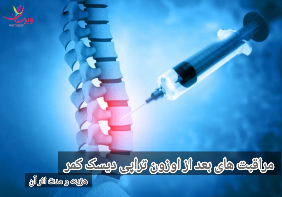 مراقبت های بعد از اوزون تراپی دیسک کمر | هزینه و مدت اثر آن