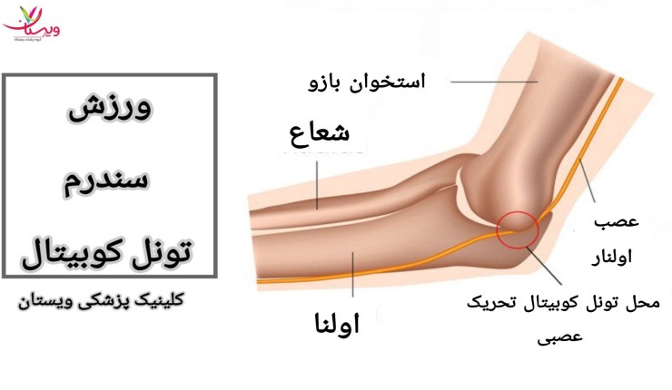 برای بهبود انعطاف پذیری آرنج، آرنج خودرا به آرامی خم و راست کنید. ورزش سندرم تونل کوبیتال