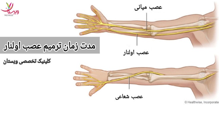 مدت زمان لازم برای ترمیم عصب اولنار به شدت آسیب و نوع درمانی که انتخاب میشود، وابسته است. مدت زمان ترمیم عصب اولنار