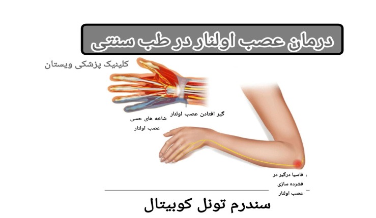 ستفاده از کمپرس گرم بر روی ناحیه آسیبدیده نیز میتواند به بهبود گردش خون و کاهش درد کمک کند. درمان عصب اولنار در طب سنتی