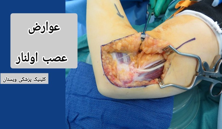 جای زخم ممکن است پس از بهبود عمل باقی بماند و در برخی موارد نیاز به درمانهای اضافی داشته باشد. عوارض عصب اولنار