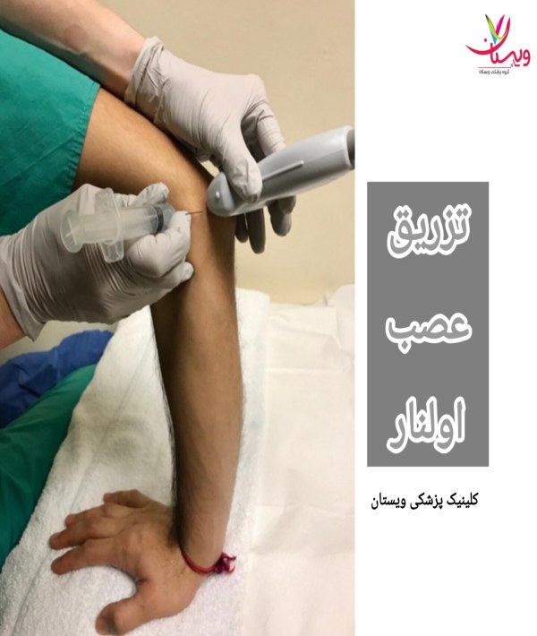 قبل از انجام تزریق، ناحیه پوست بیمار با الکل یا محلول بتادین ضدعفونی میشود تا خطر عفونت به حداقل برسد. تزریق عصب اولنار