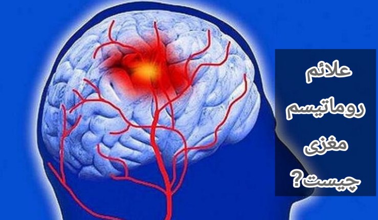 از علائم روماتیسک مغزی می توان به خستگی، تب و کاهش اشتها اشاره کرد.ا علائم روماتیسم مغزی