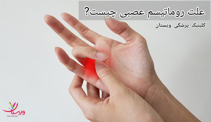 وضعیتهای روانی و استرسهای زیاد میتوانند به تشدید علائم روماتیسم عصبی کمک کنند و بر کیفیت زندگی فرد تأثیر منفی بگذارند.