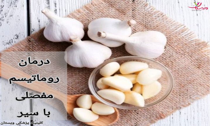 گنجاندن سیر به صورت خام یا پخته در رژیم غذایی روزانه نیز میتواند به بهبود وضعیت مفاصل کمک کند. درمان روماتیسم مفصلی با سیر