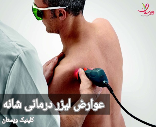 لیزر درمانی شانه به طور کلی به عنوان یک روش ایمن شناخته میشود، با این حال، ممکن است برخی عوارض جانبی خفیف و موقتی در پی داشته باشد. عوارض لیزر درمانی شانه