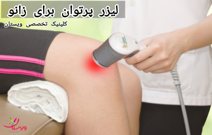 این نوع لیزر با نفوذ به عمق بافتها، سلولها را تحریک کرده و تولید ATP (آدنوزین تری فسفات) را افزایش میدهد که انرژی لازم برای ترمیم و بازسازی بافتها را فراهم میآورد. لیزر پروان برای زانو