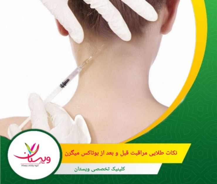 از مصرف الکل و داروهای رقیقکننده خون تا چند روز پس از تزریق پرهیز کنید. نکات طلایی مراقبت قبل و بعد از بوتاکس میگرن
