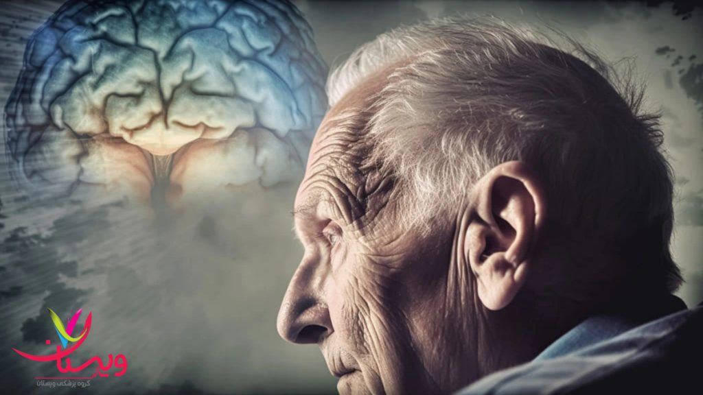 تاثیرات آلزایمر بر مغز و حافظه مرد مسنی که به آلزایمر مبتلا شده