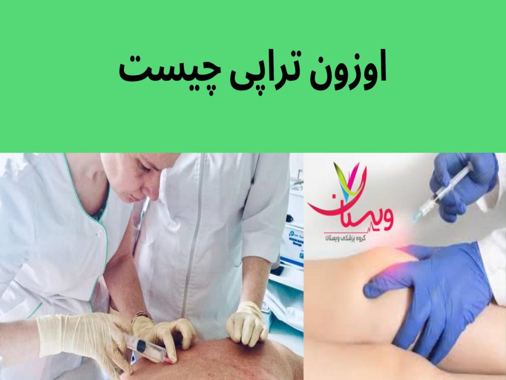 اوزون تراپی اوزون تراپی چیست