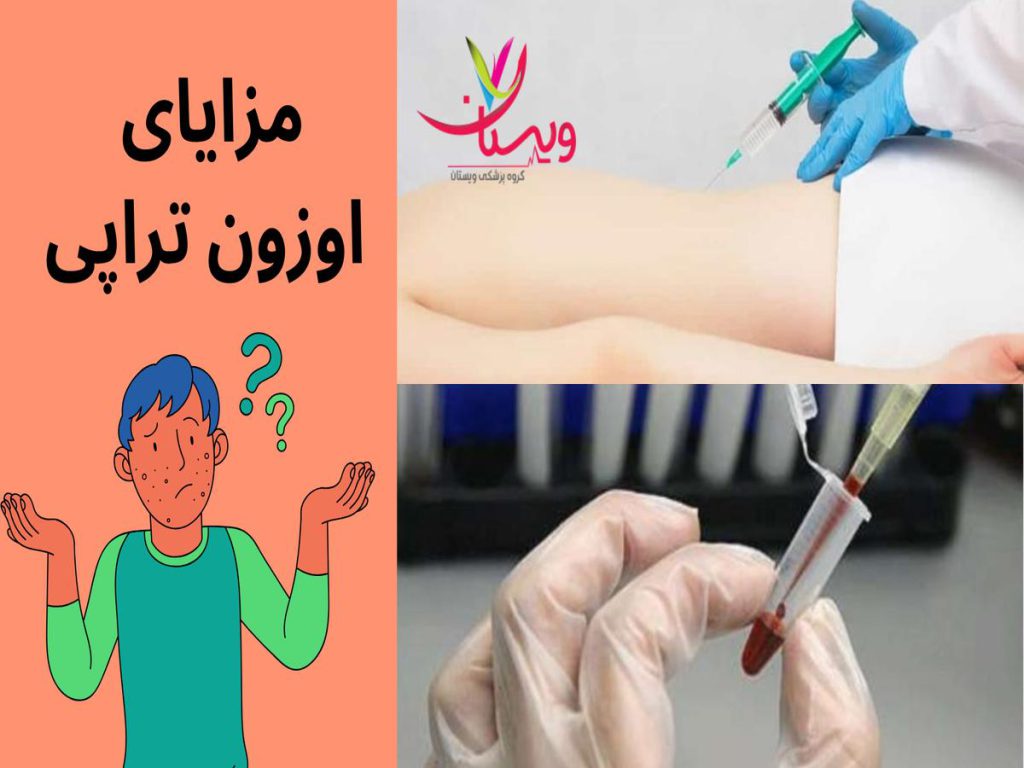 دردهای مفصلی مزایای اوزون تراپی