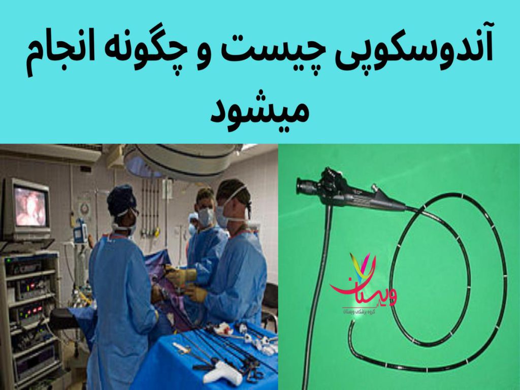 آندوسکوپی معده آندوسکوپی چیست و چگونه انجام میشود