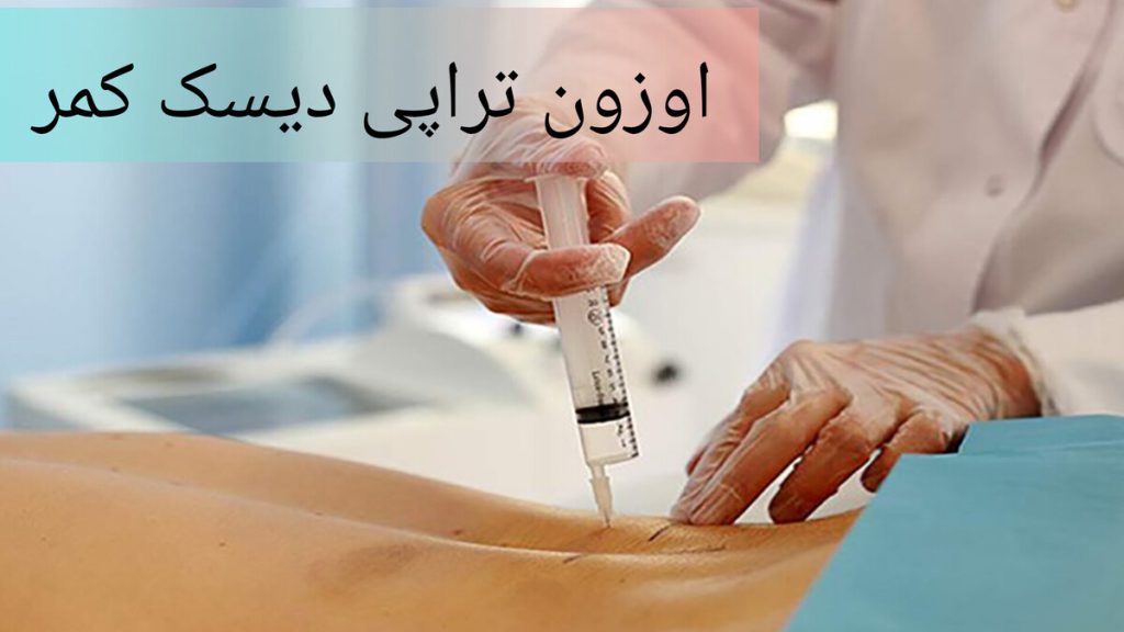تزریق اوزون به ستون فقرات برای درمان دیسک کمر